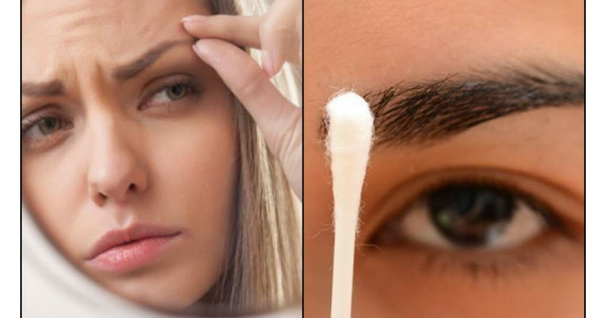 What to Do to Thicken Eyebrows? Natural And Herbal Remedies For Thickening Eyebrows