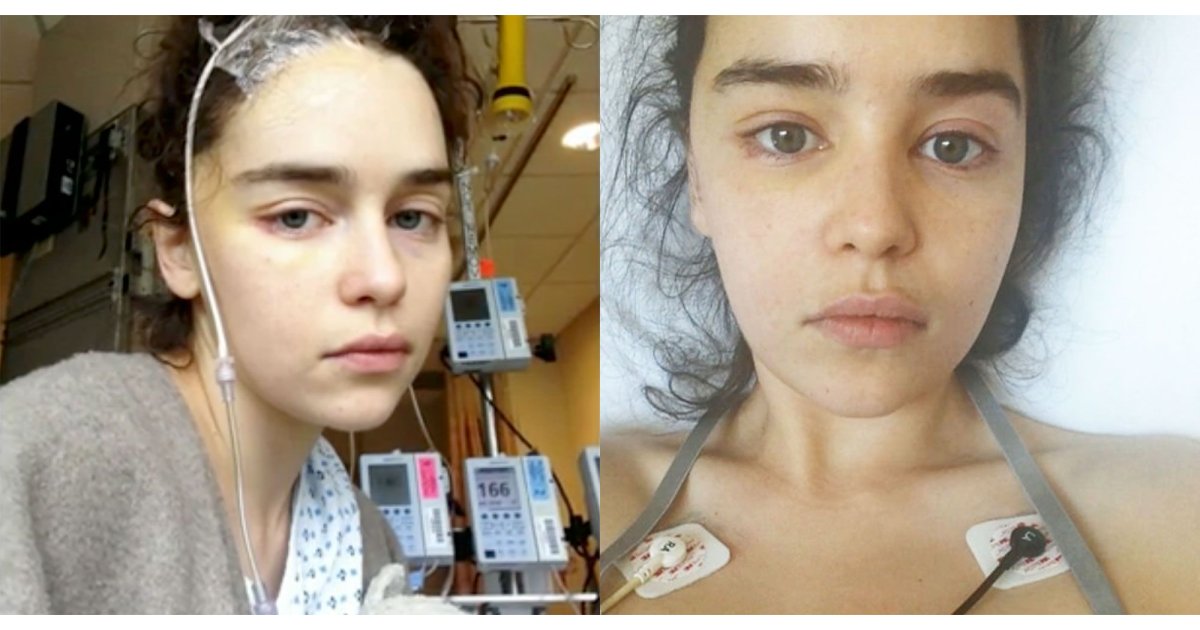 Emilia Clarke after brain surgery: It's a miracle I've been able to get on with my life