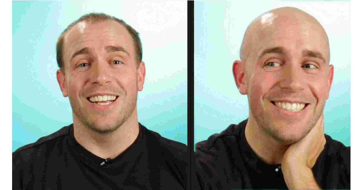 Bald Meaning and Definition