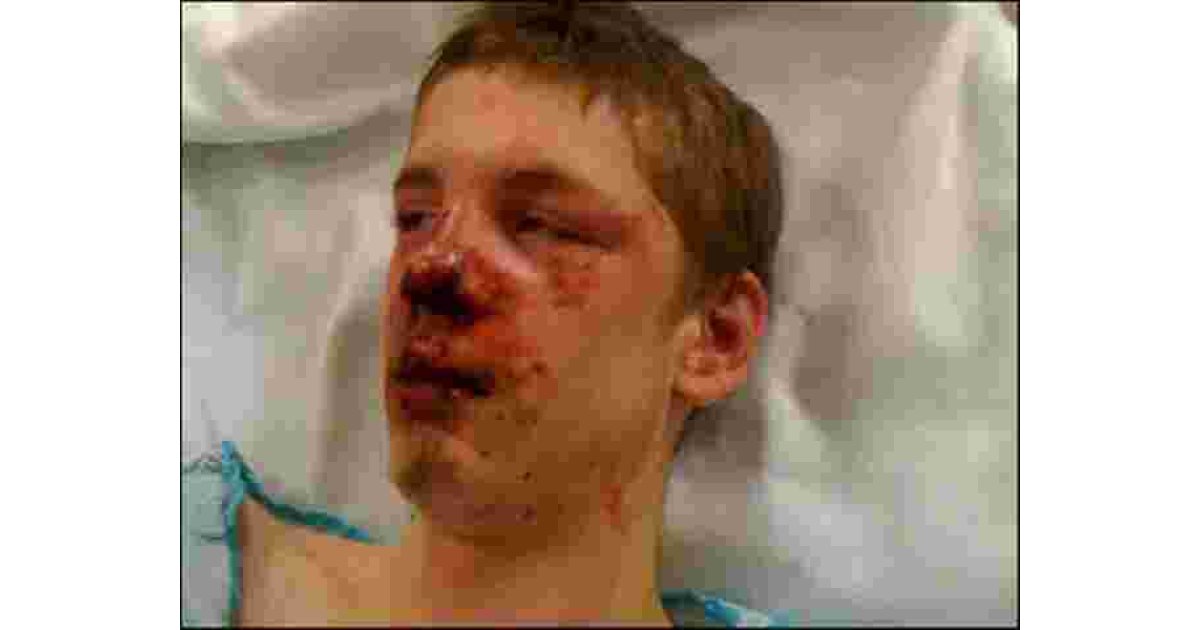 Beaten Meaning and Definition