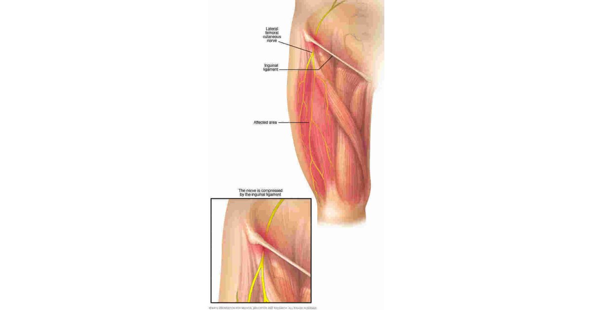 Bilateral Meaning and Definition