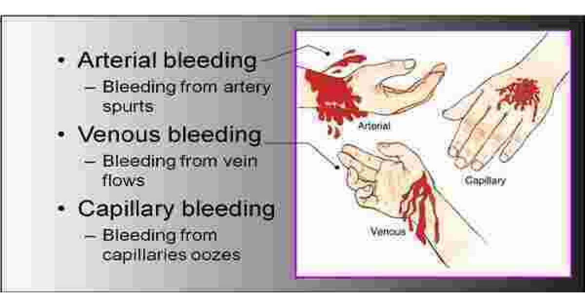 Bleeding Meaning and Definition