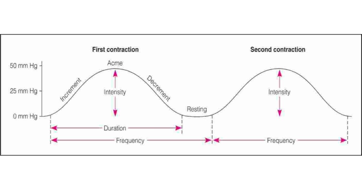 Contraction Meaning and Definition
