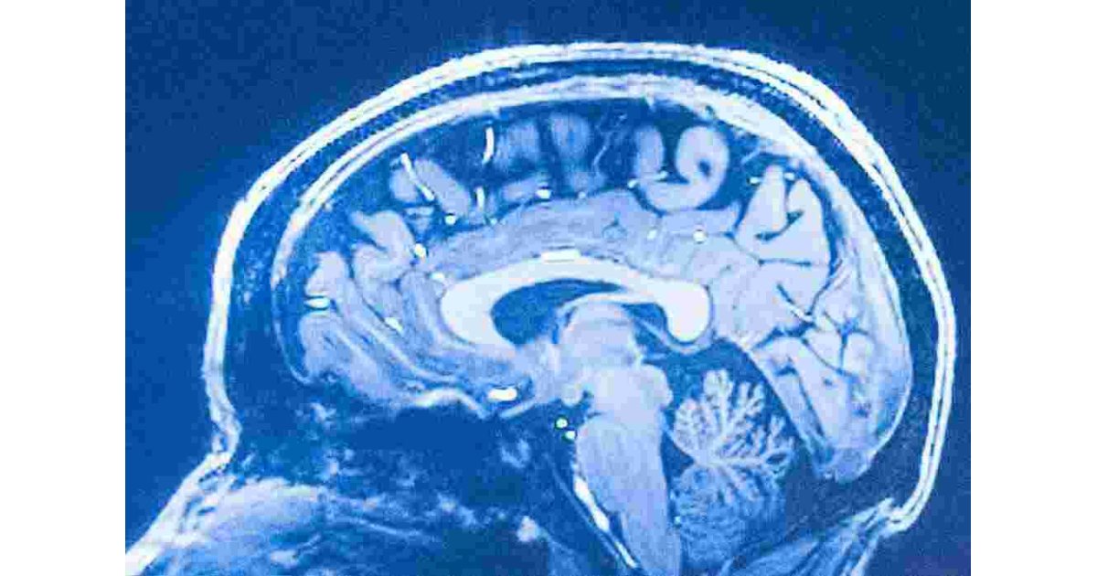 Neuroscience Meaning and Definition