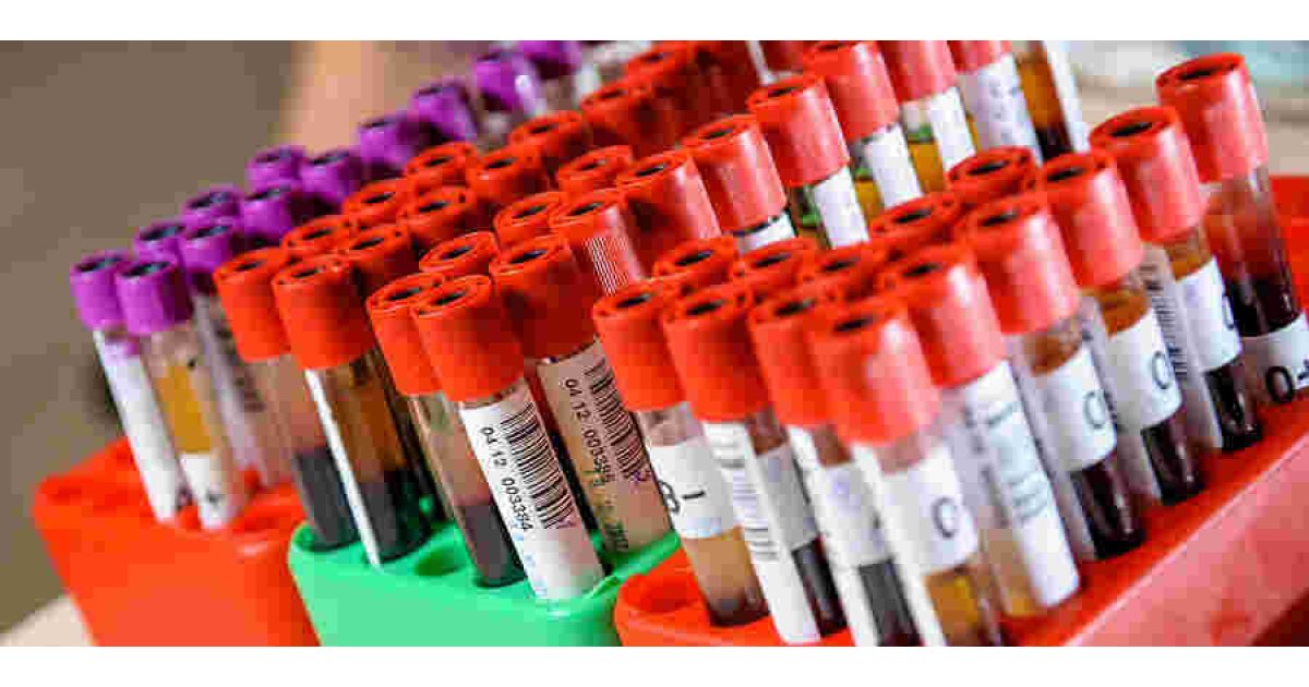 Specimen Meaning and Definition