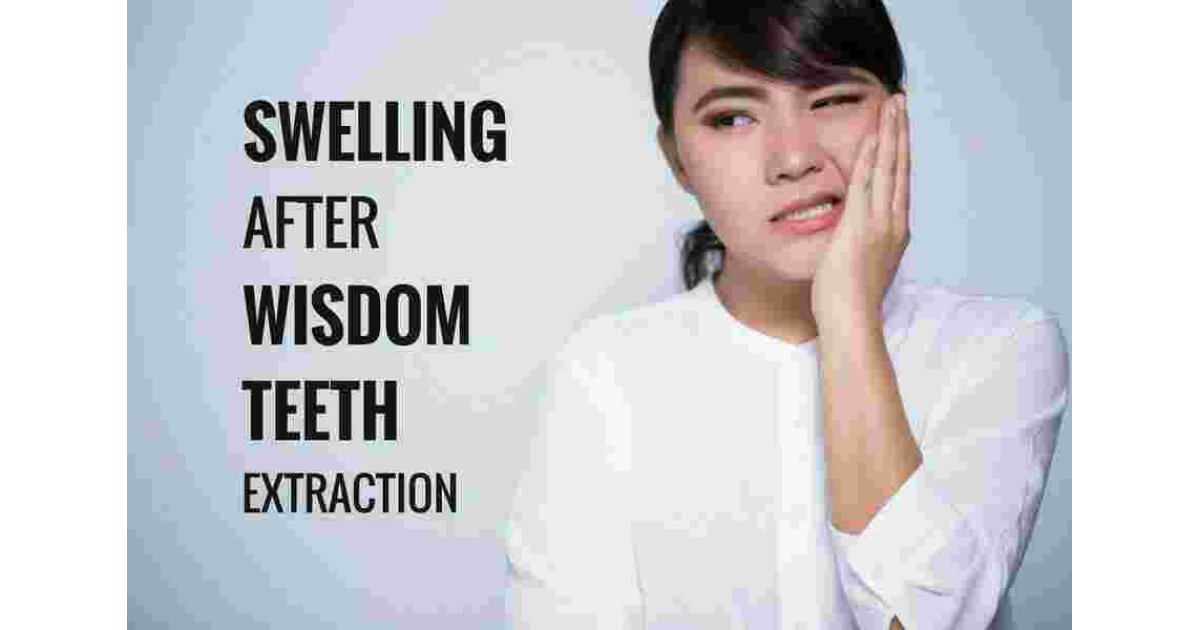 Swelling Meaning and Definition