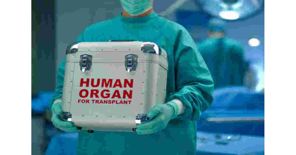 Transplant Meaning and Definition