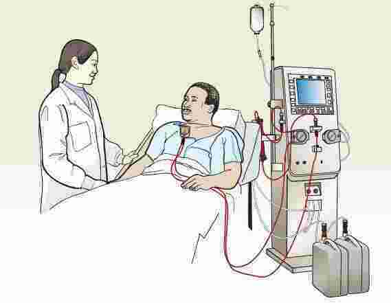 Dialysis Meaning and Definition