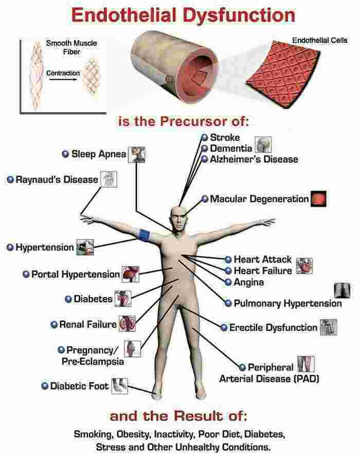 Dysfunction Meaning and Definition
