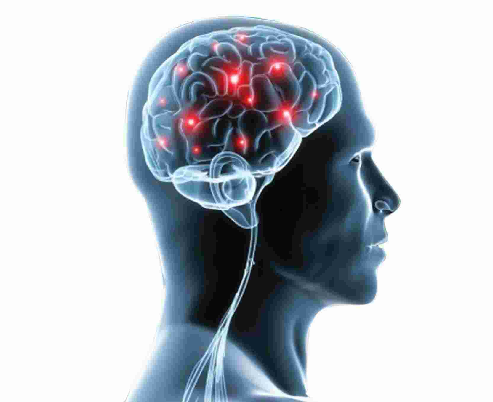 Neurology Meaning and Definition