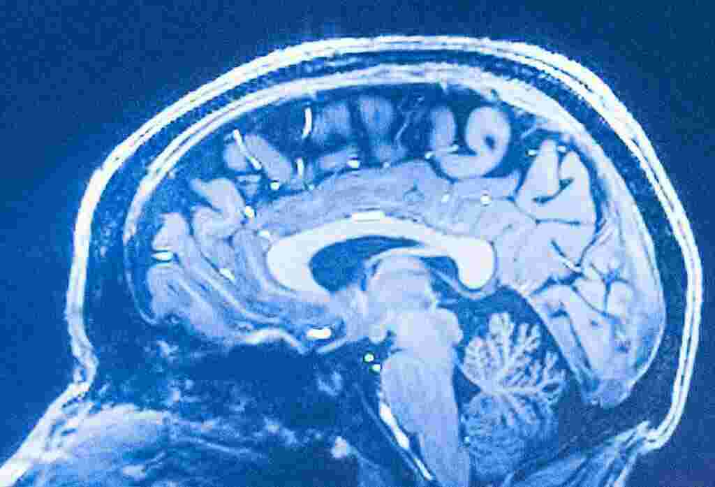 Neuroscience Meaning and Definition