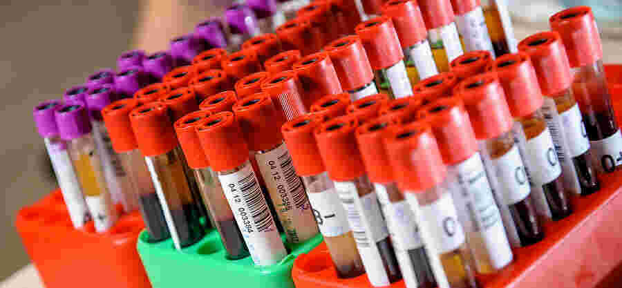 Specimen Meaning and Definition