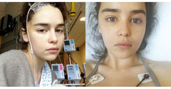 Emilia Clarke after brain surgery: It's a miracle I've been able to get on with my life
