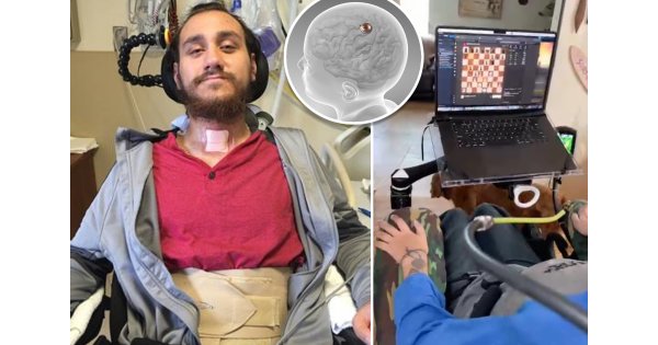 First human with Neuralink brain chip demonstrates moving cursor with his mind: 'Can't even describe how cool it is' First human with Neuralink brain chip demonstrates moving cursor with his mind: 'Can't even describe how cool it is'