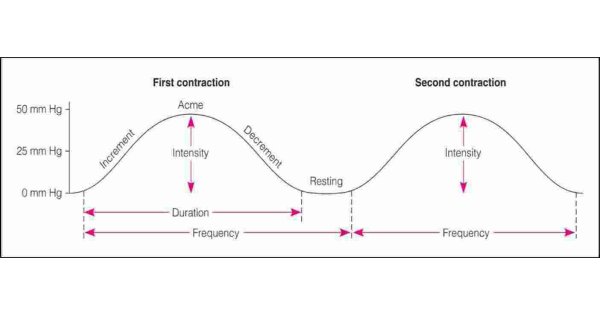 Contraction Meaning and Definition Contraction Meaning and Definition