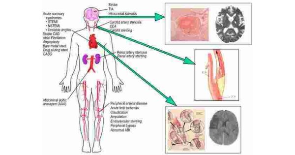 Etiology Meaning and Definition