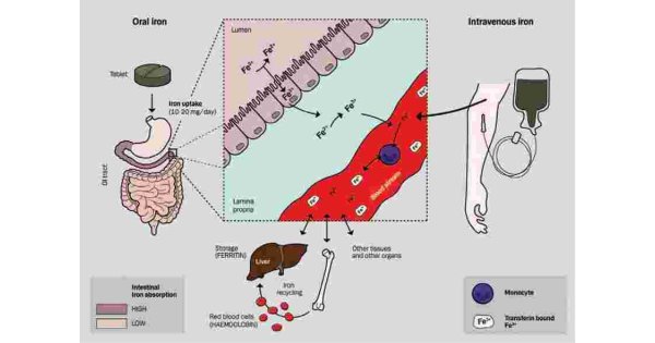 Intravenous Meaning and Definition
