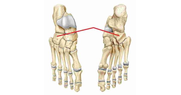 Lateral Meaning and Definition