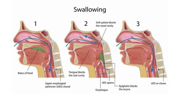 Swallowing Meaning and Definition Swallowing Meaning and Definition