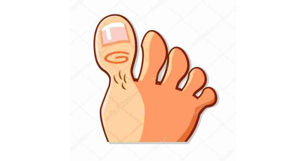 Toe Meaning and Definition
