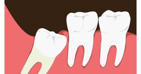 Tooth Meaning and Definition Tooth Meaning and Definition