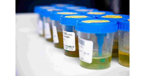 Urine Meaning and Definition