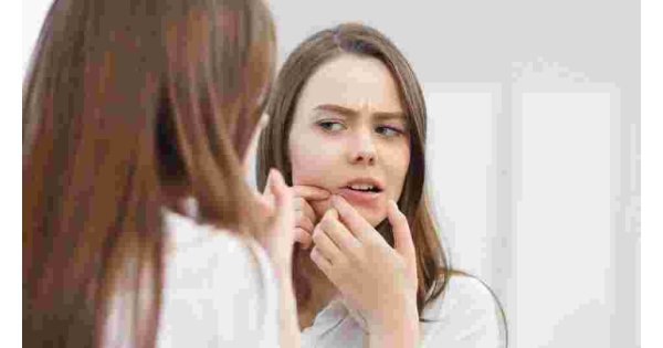 How to get rid of acne? Best acne treatment... Acne cleaning...