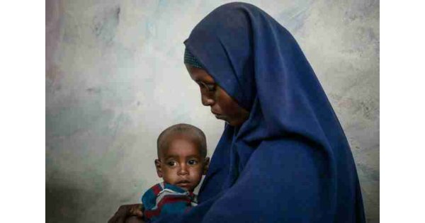 Statement by UNICEF: 400,000 children in Yemen could die at any time from malnutrition