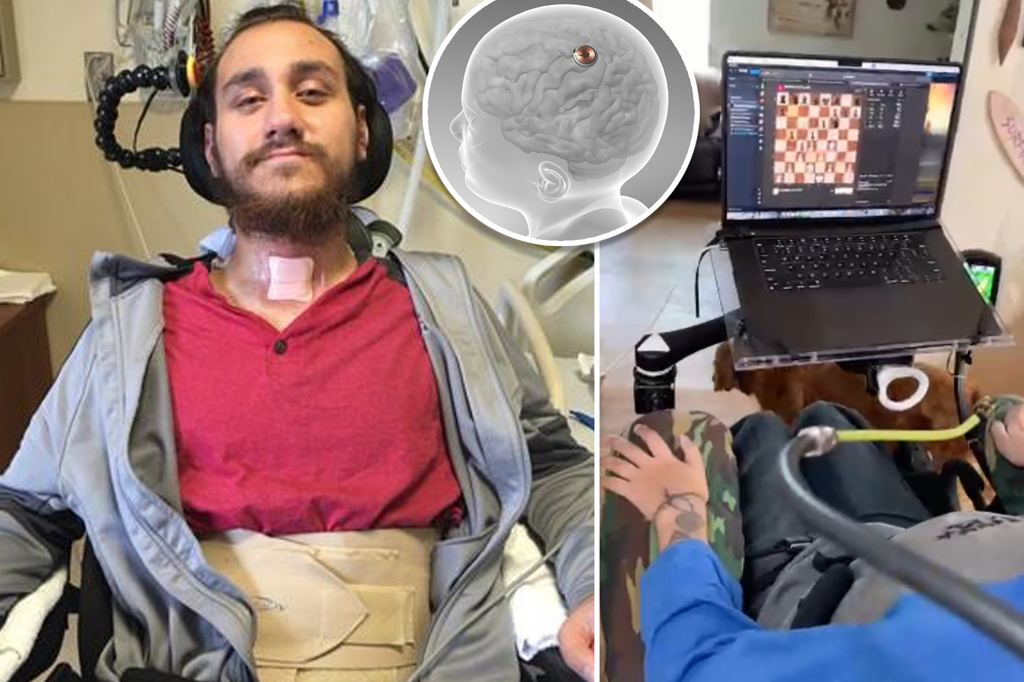 First human with Neuralink brain chip demonstrates moving cursor with his mind: 'Can't even describe how cool it is' 