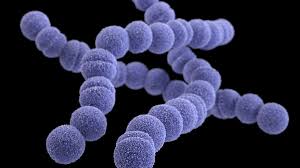 SYMPTOMS OF STREP A: What is Strep A, how is it transmitted, what are the symptoms, is it fatal, is there a cure?
