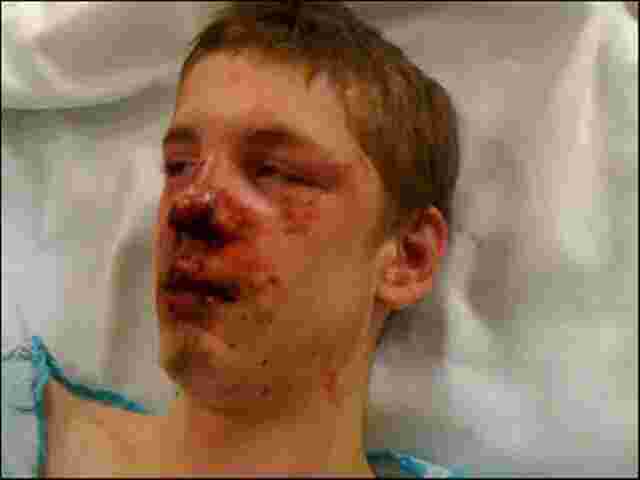 Beaten Meaning and Definition