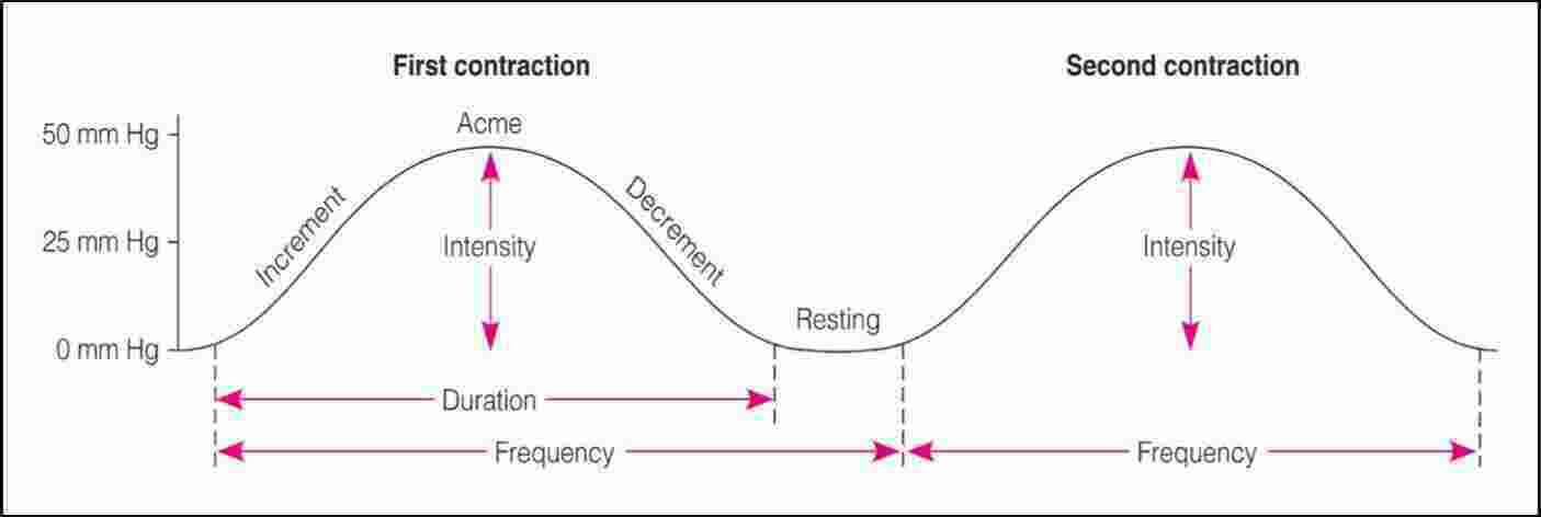 Contraction Meaning and Definition