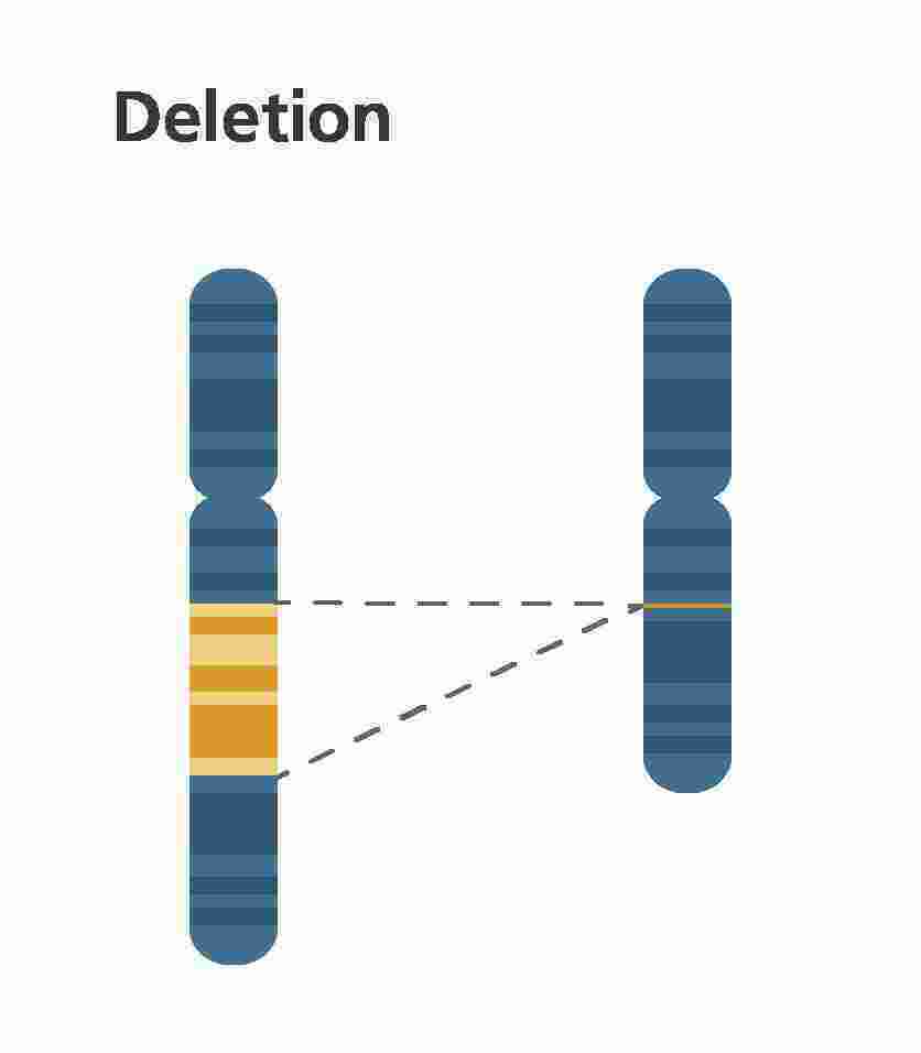 Deletion Meaning and Definition