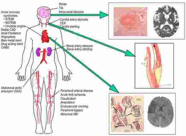 Etiology Meaning and Definition