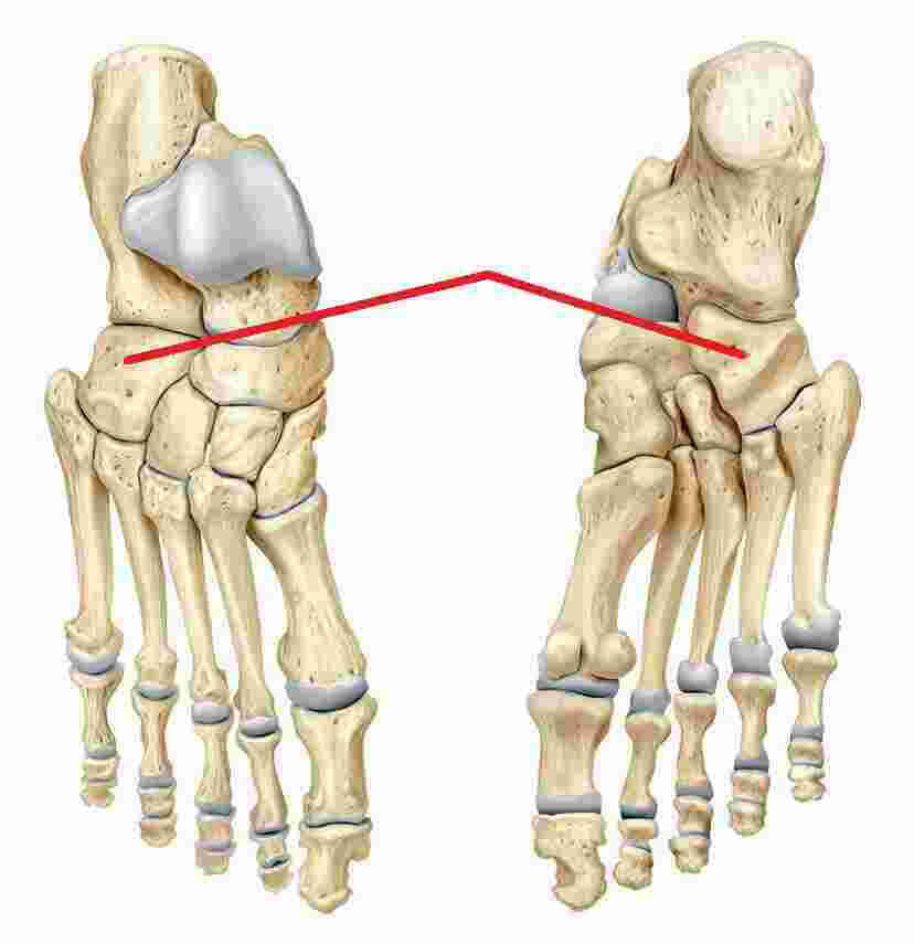 Lateral Meaning and Definition