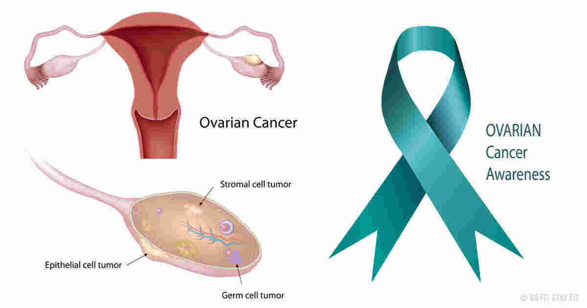 Ovarian Meaning and Definition