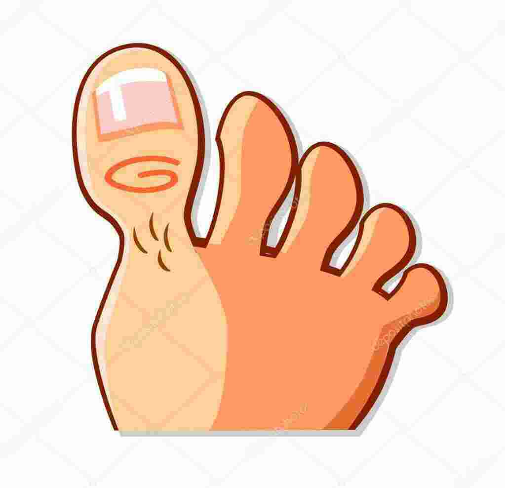 Toe Meaning and Definition