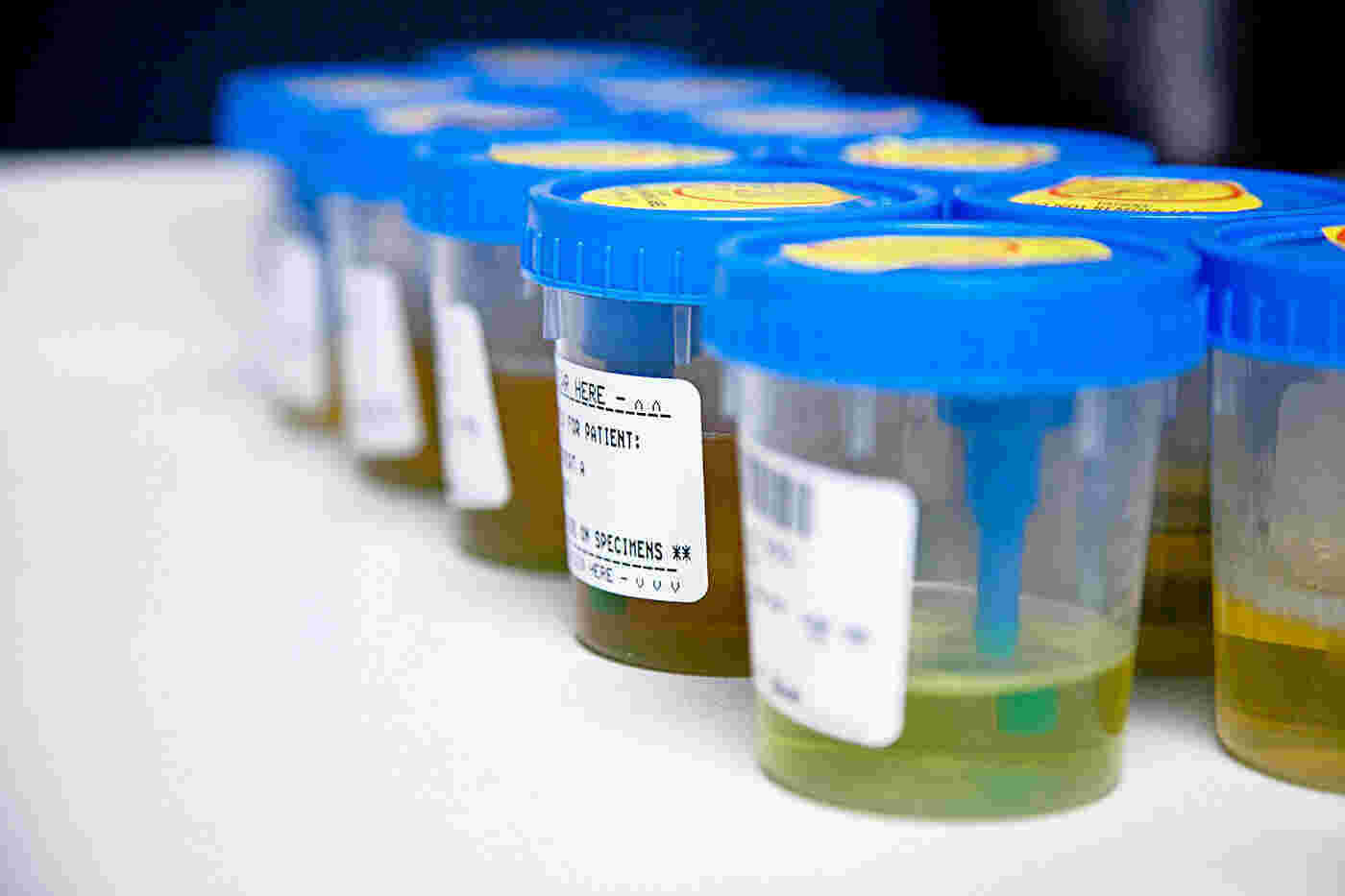 Urine Meaning and Definition