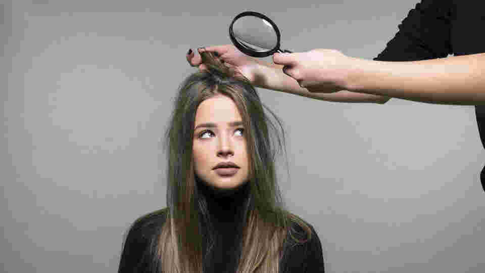 What causes dandruff in the hair?