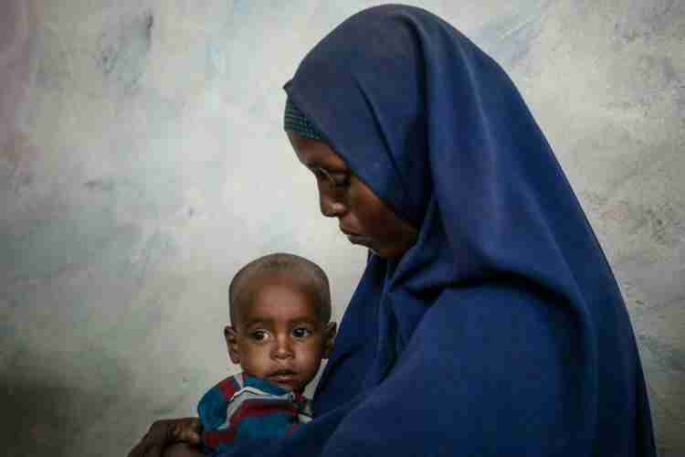 Statement by UNICEF: 400,000 children in Yemen could die at any time from malnutrition