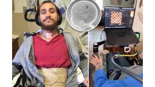 First human with Neuralink brain chip demonstrates moving cursor with his mind: 'Can't even describe how cool it is' 