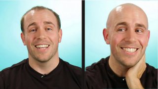 Bald Meaning and Definition