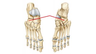 Lateral Meaning and Definition