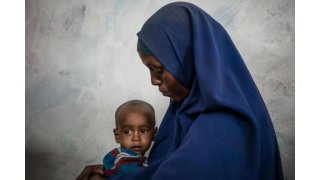 Statement by UNICEF: 400,000 children in Yemen could die at any time from malnutrition