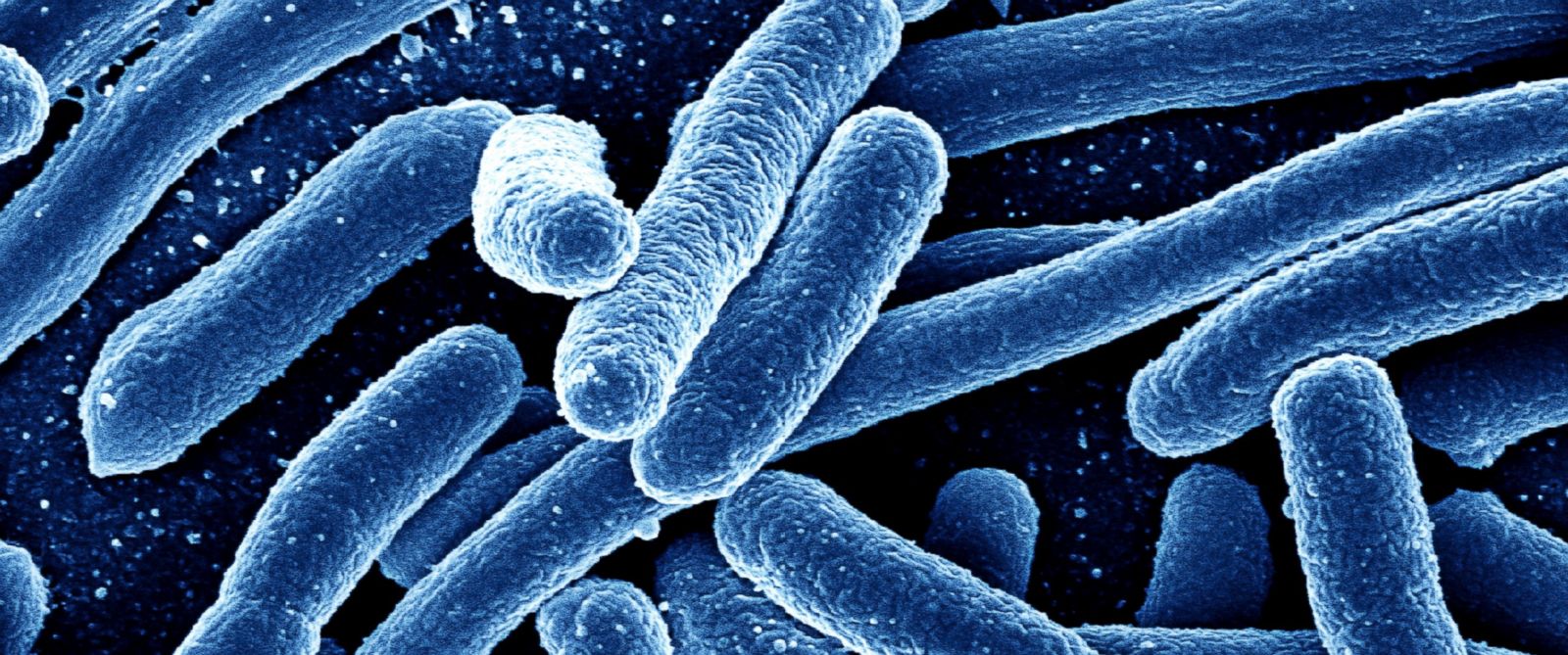 Bacteria Meaning and Definition