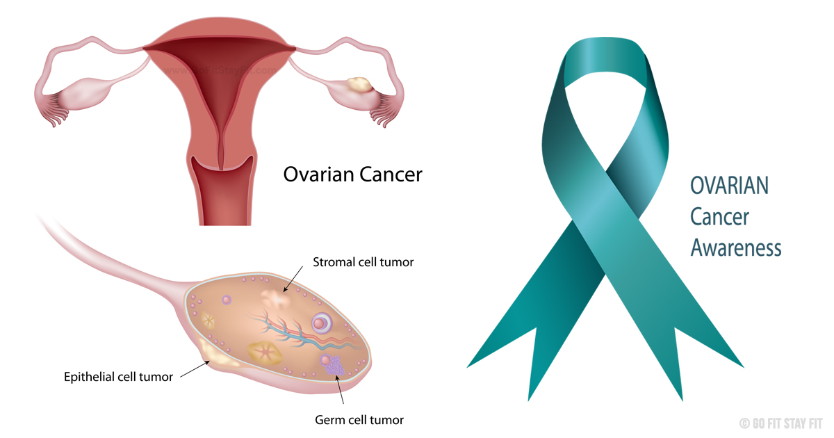 Ovarian Meaning and Definition