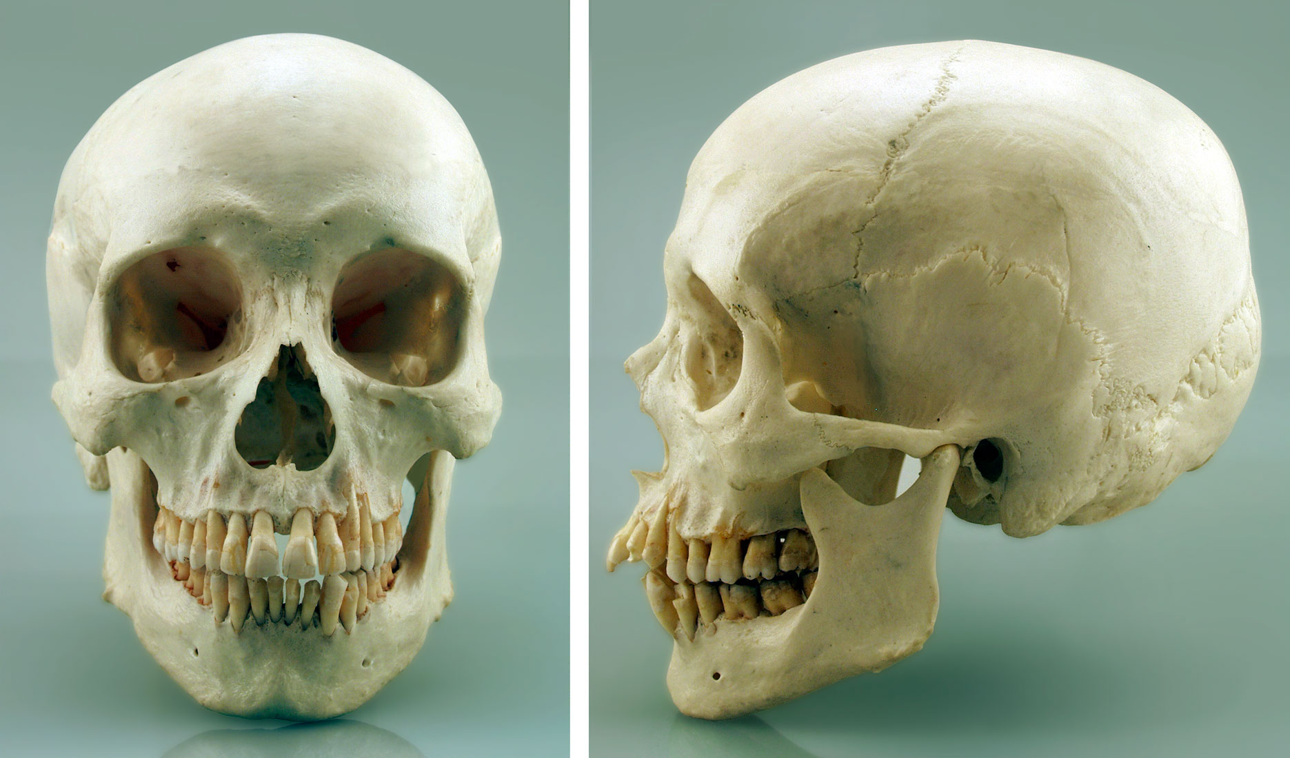 Skull Meaning and Definition
