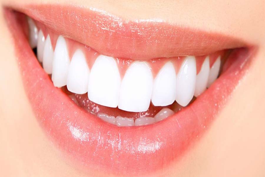 Teeth Meaning and Definition
